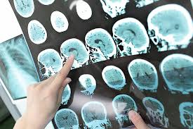 💊 REQUEST FOR SUPPLY OF ONCOLOGY, MULTIPLE SCLEROSIS, HEMATOLOGY AND THALASSEMIA MEDICINES FOR THE SYRIAN MARKET.
