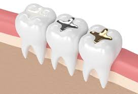🦷 Import Demand for Dental Filling Materials – For the Egyptian Market