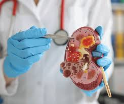 🏥 Urology Supplies and Medical Equipment Manufacturer Demand – For the Egyptian Market