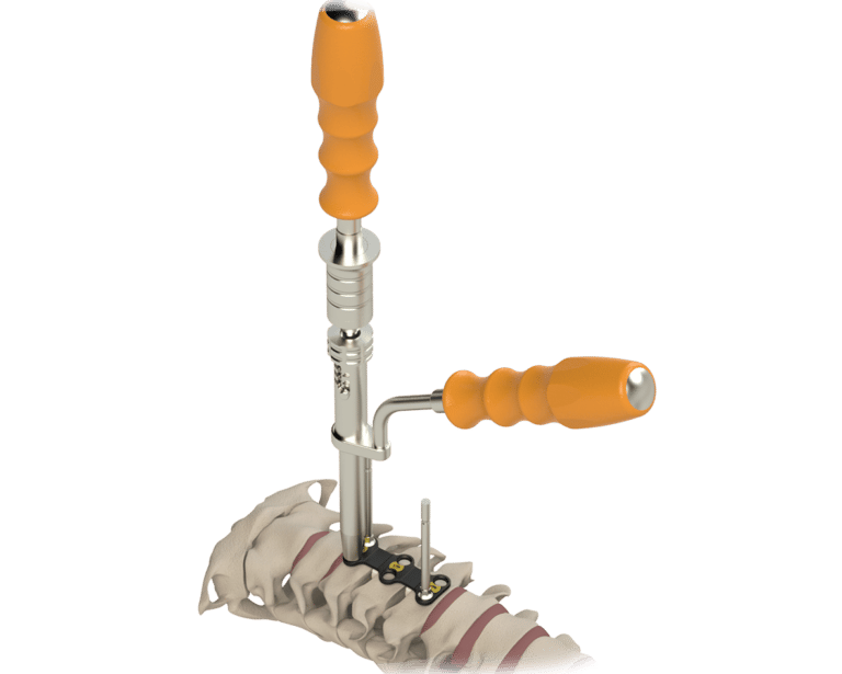SPINAL- & TRAUMAIMPLANTATE – FORTSCHRITTLICHE ORTHOPÄDISCHE LÖSUNGEN
