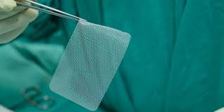 🏥 UK Medical Supply Tender – GBP 100 Million Contract for Surgical Mesh and Immobilizer Devices